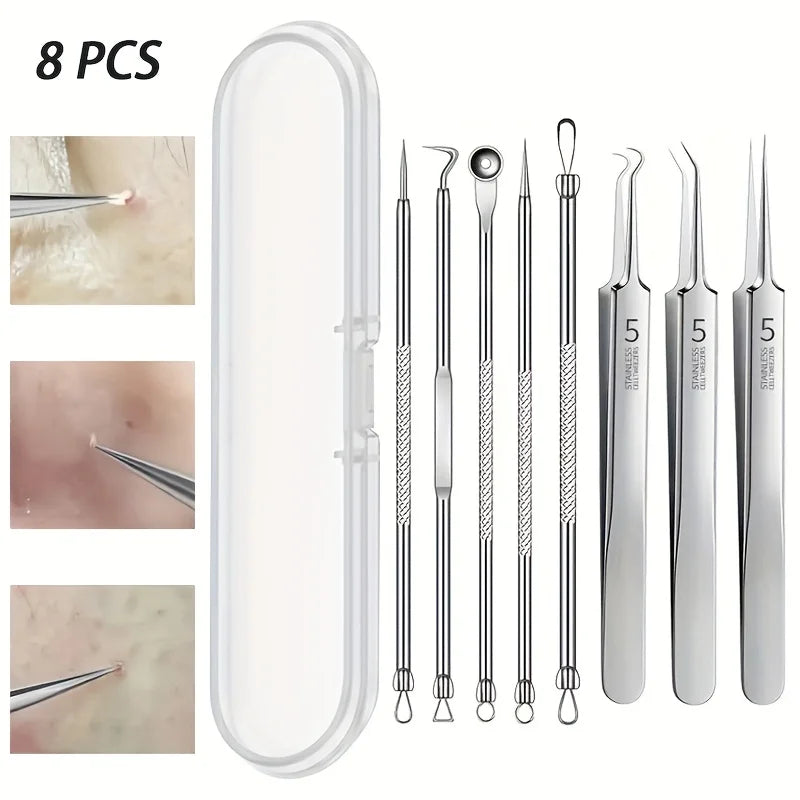 PureSkin Pro Blackhead Remover Kit – Stainless Steel Acne & Blemish Extraction Tools